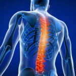 Doctor for Back Pain Treatment in Thane